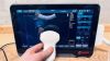 ESAOTE MyLab X1 Ex demo 2022 With linear & convex & sector Portable Ultrasound