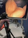 OLYMPUS CF-H190L Colonoscope