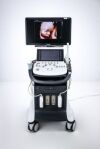 DIAGNOSTIC ULTRASOUND Samsung WS80A Elite Ultrasound Machine