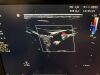 PHILIPS Sparq Ultrasound - Shared Service