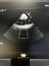 PHILLIPS Transesophageal X7-2T Compact Ultrasound Transducer