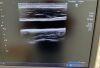TOSHIBA PLU-704BT Ultrasound Transducer
