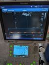 TOSHIBA PVU-375BT Ultrasound Transducer