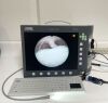 KARL STORZ STORZ TELEPACK TP-100