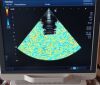 TOSHIBA PST-30BT Ultrasound Transducer
