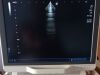 TOSHIBA PST-30BT Ultrasound Transducer