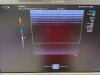 SIEMENS S2000 HELX TOUCH ULTRASOUND SCANNER