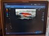 TOSHIBA PLT-1005BT Ultrasound Transducer