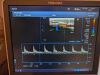 TOSHIBA PLT-1005BT Ultrasound Transducer
