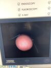 KARL STORZ Telecam SL 202120 20 Bronchoscope
