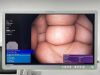 OLYMPUS PCF-H190L Scope Endoscope