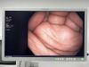 OLYMPUS PCF-H190L Scope Endoscope