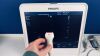 PHILIPS CX50 Ultrasound - Cardiac