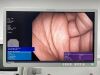 OLYMPUS PCF-H190DL Scope Endoscope