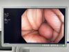 OLYMPUS PCF-H190DL Scope Endoscope