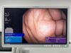 OLYMPUS PCF-H190DL Scope Endoscope