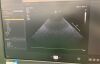 PHILIPS S5-1 Ultrasound Transducer