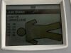 WELCH ALLYN CP1A ECG unit