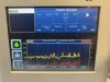 COVIDIEN *LOT OF 11*  BIS Complete Patient Monitoring System 185-0151 194-0405 194-0386 Monitor