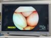 STRYKER 0240031000 VISIONPRO LED HD DISPLAY  MONITOR