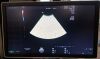 GE C1-5-D Ultrasound Transducer