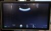 GE C1-5-D Ultrasound Transducer