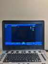 MINDRAY M9 Portable Ultrasound System Ultrasound - Shared Service