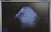 SONOSITE FujiFilm  P21x/5-1 MHz Ultrasound Transducer P07698-21 - 196779 Ultrasound Transducer