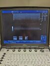 GE Vivid E Ultrasound - Shared Service