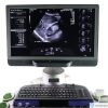 ACUSON Siemens  S3000 HELX Ultrasound System  4 Probes
