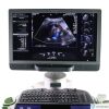 ACUSON Siemens  S3000 HELX Ultrasound System  4 Probes