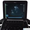 SONOSITE P21x/5-1 Ultrasound Transducer