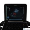 SONOSITE P21x/5-1 Ultrasound Transducer