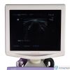 ALOKA PROSOUND ALPHA 6 Ultrasound - OB / GYN