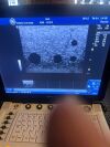 GE L412TRS Ultrasound Transducer