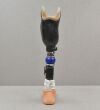 OSSUR Re-Flex VSP Ceterus Vertical Shock Left Prosthetic Foot W/ Foot Shell - 197313 Prosthetics