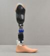 OSSUR Re-Flex VSP Ceterus Vertical Shock Left Prosthetic Foot W/ Foot Shell - 197313 Prosthetics
