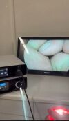 STRYKER 1688 4K CAMERA, L11 LIGHT SOUCE  AND 4K MONITOR