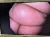 OLYMPUS GIF-HQ190 Gastroscope