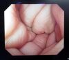 OLYMPUS GIF-KH260 Endoscope