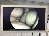 FUJI VP-4450&XL-4450 Endoscopy Processor