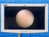 RICHARD WOLF 7305.006 Cystoscope