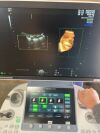GE Voluson S10 Ultrasound - OB / GYN
