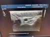 PHILIPS L12-5 Ultrasound Transducer