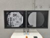SIEMENS Siremobil Compact L C-Arm