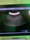GE Vivid E90 Cardiac Ultrasound Systems w/ C2-9-D & M5Sc-D Probes