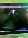 GE Vivid E90 Cardiac Ultrasound Systems w/ C2-9-D & M5Sc-D Probes