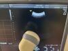 GE Voluson E6 Ultrasound - Shared Service