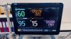 DRAEGER Primus Anesthesia Machine