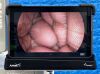 ARTHREX Synergy HD3 Tower Laparoscope